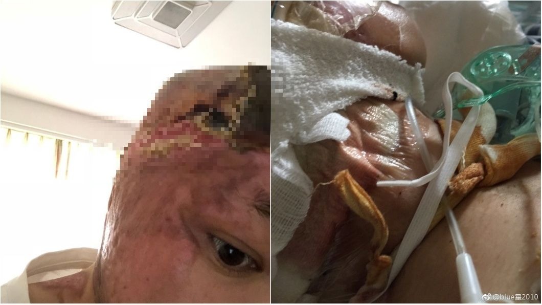 藍星表示自己燒炭輕生後，沒死成反而重傷進ICU，不料丈夫卻和小三跑去拍婚紗。圖／翻攝自《微博》