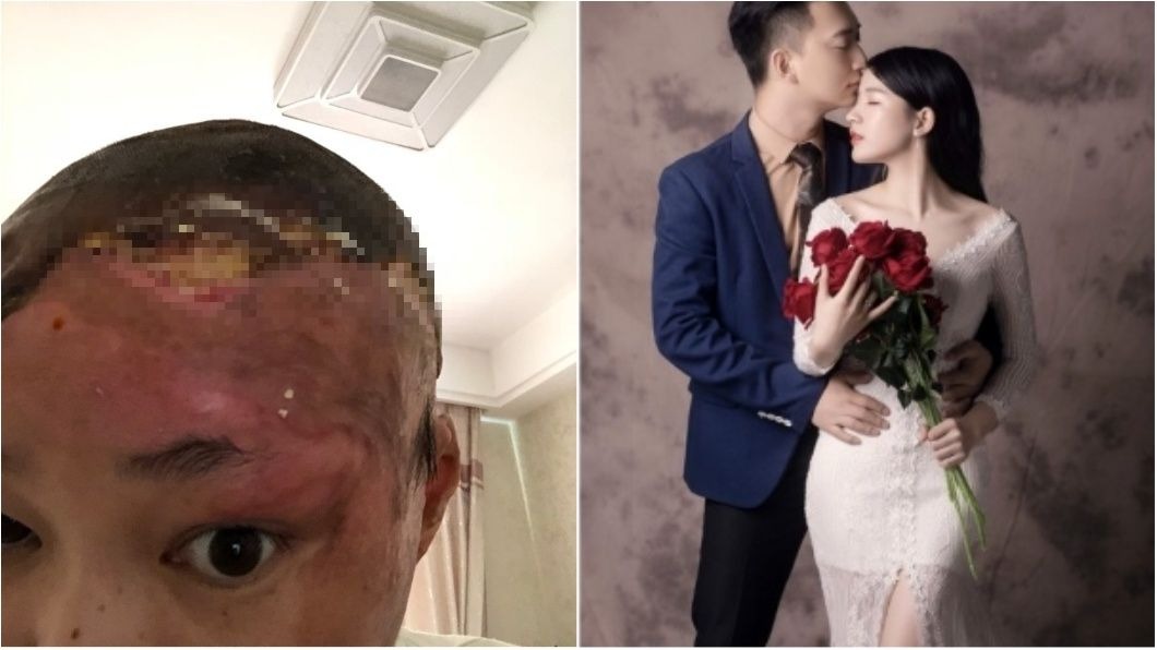 迫於輿論壓力下，丈夫已先歸還藍星當初向娘家借的錢，目前雙方正在爭取女兒扶養權。圖／翻攝自《微博》