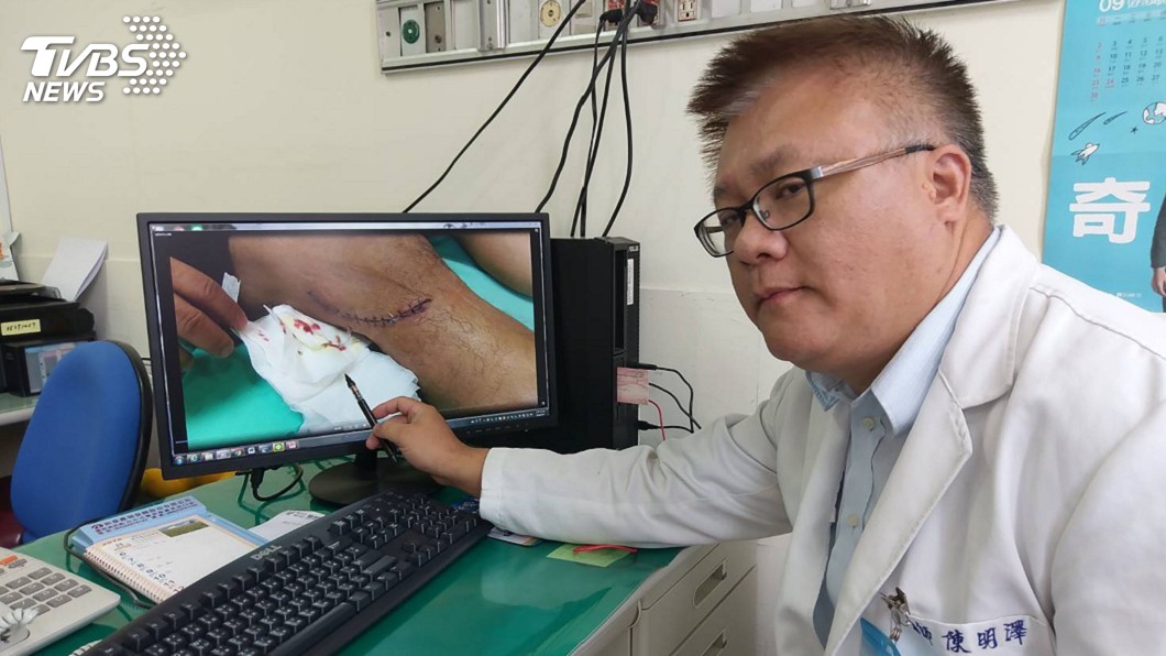 浴室磁磚割傷右腿 男子傷口感染大便細菌