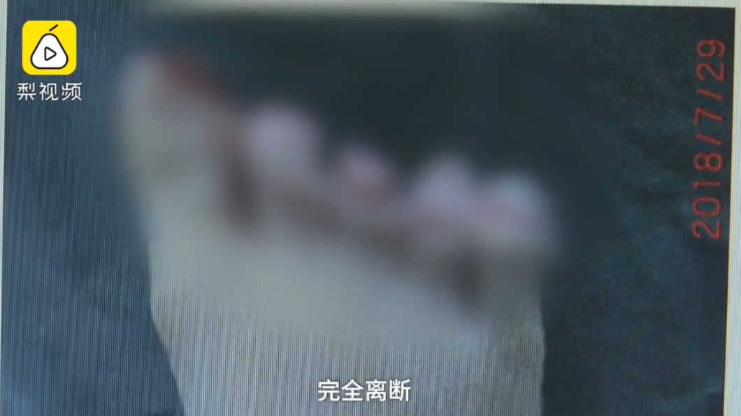 趁沒人偷玩切布機 男童5趾全遭切斷當場爆血