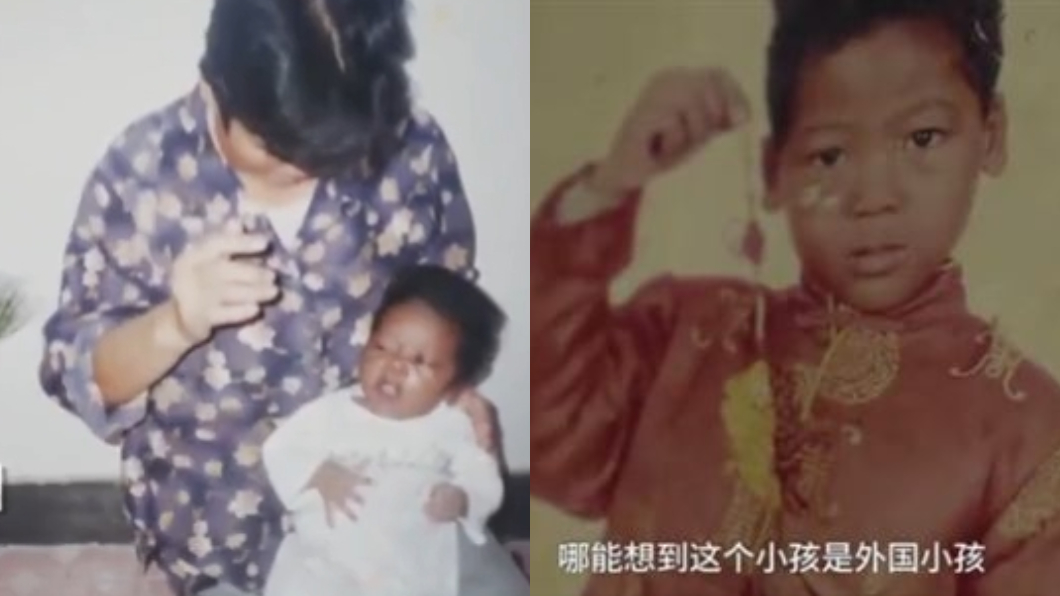 連洗了7天還是覺得髒 阿婆抱孫送醫才知「是黑人」