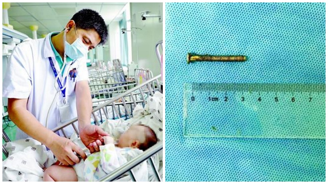2月大女嬰腹驚見螺絲釘 3歲姊是「兇手」貪玩餵食