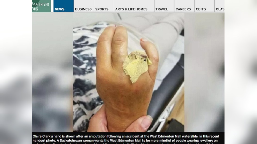 玩滑水道忘拔戒指 卡在水道上一隻手指頭就沒了...