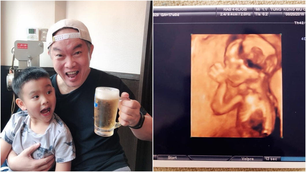 50歲再當爸!康康秀第二胎超音波照:前世情人來了