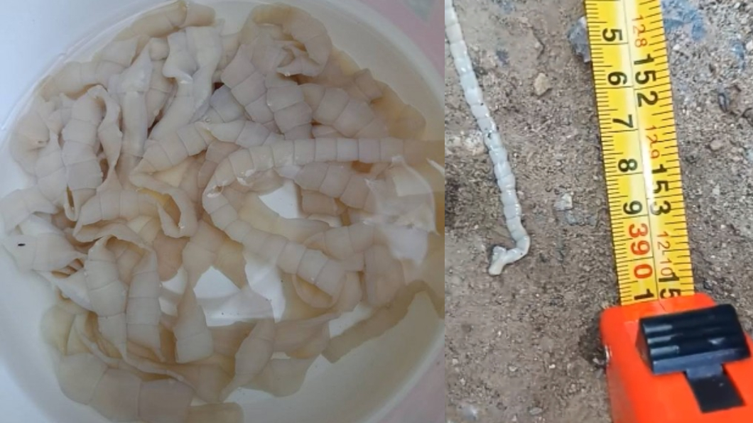 天啊!男子愛吃半熟肉 便便竟拉出4公尺「寬版麵」