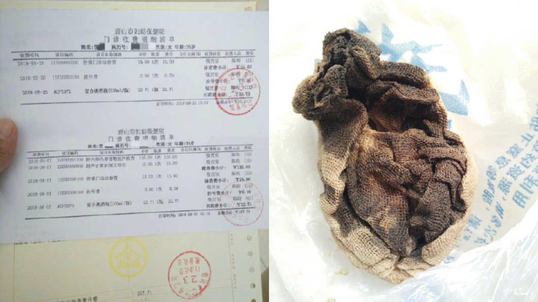 下體散發惡臭、流液體　女子體內取出「發黑化膿紗布」
