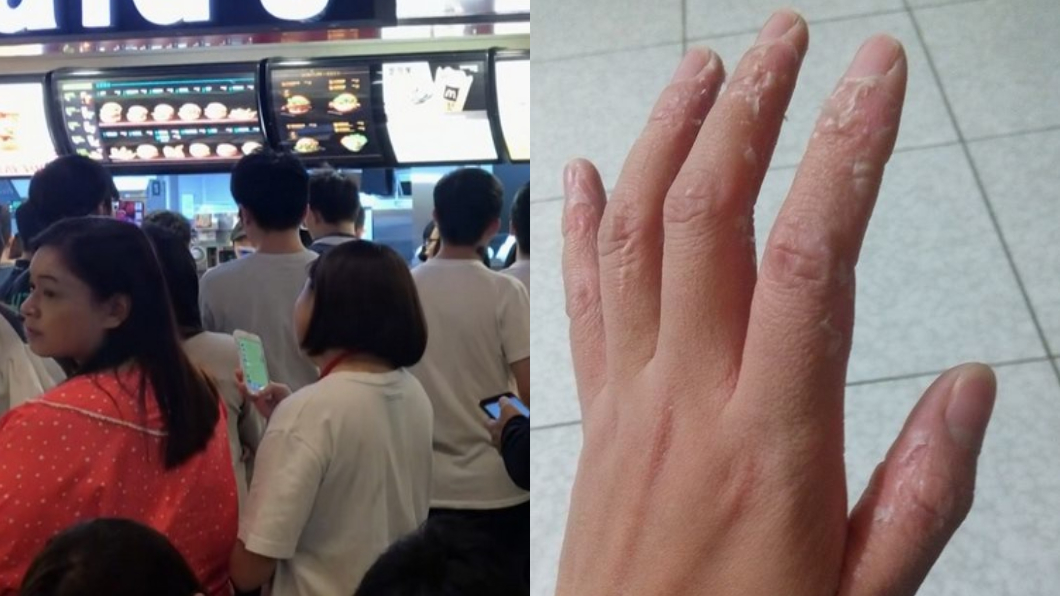 「麥當勞之亂」打烊班員工手泡爛脫皮　嘆：錢真難賺