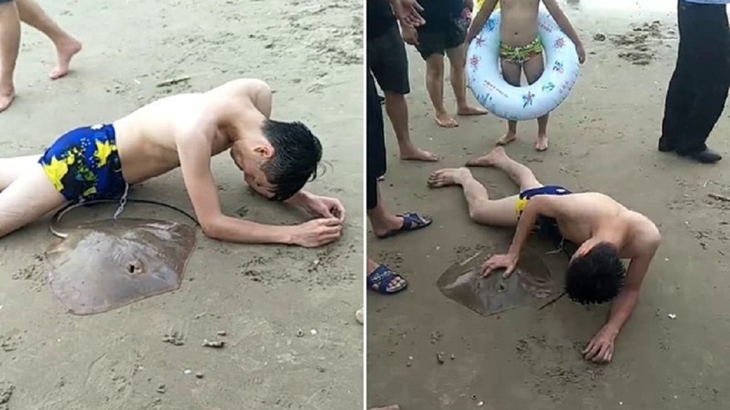 衰男海邊玩水遭魟魚「刺中下體」 救難人員當機剪斷