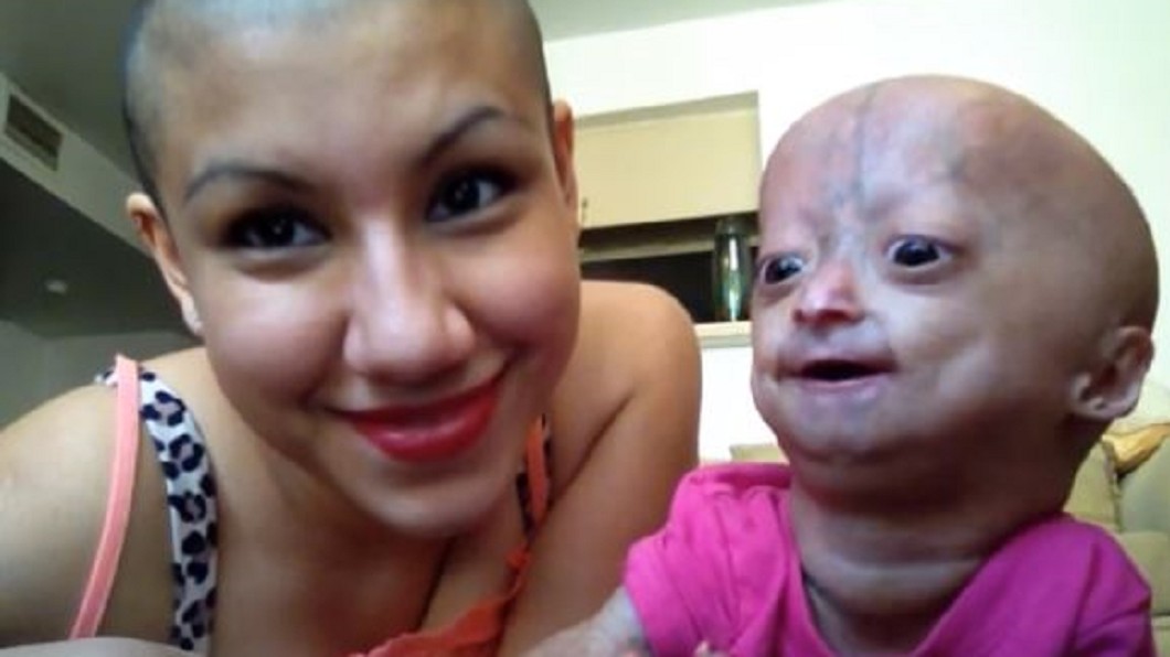 圖/翻攝自Adalia Rose YouTube