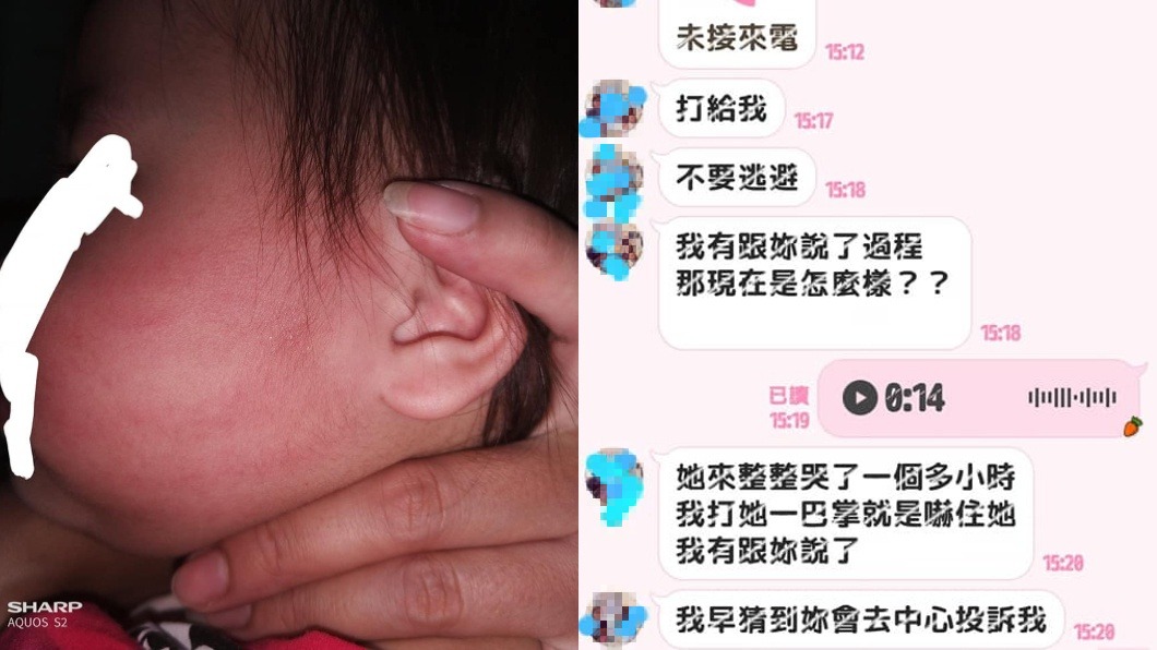 女嬰臉頰大片紅腫掌痕 保母竟回:不然我兒子讓妳打回來