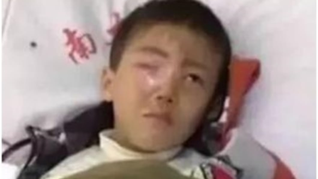 把乾燥劑丟進飲料罐 男童眼球當場溶解失明