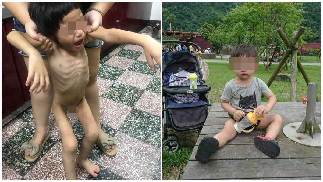 快訊/男童疑受虐! 生父、同居人移送地檢署複訊