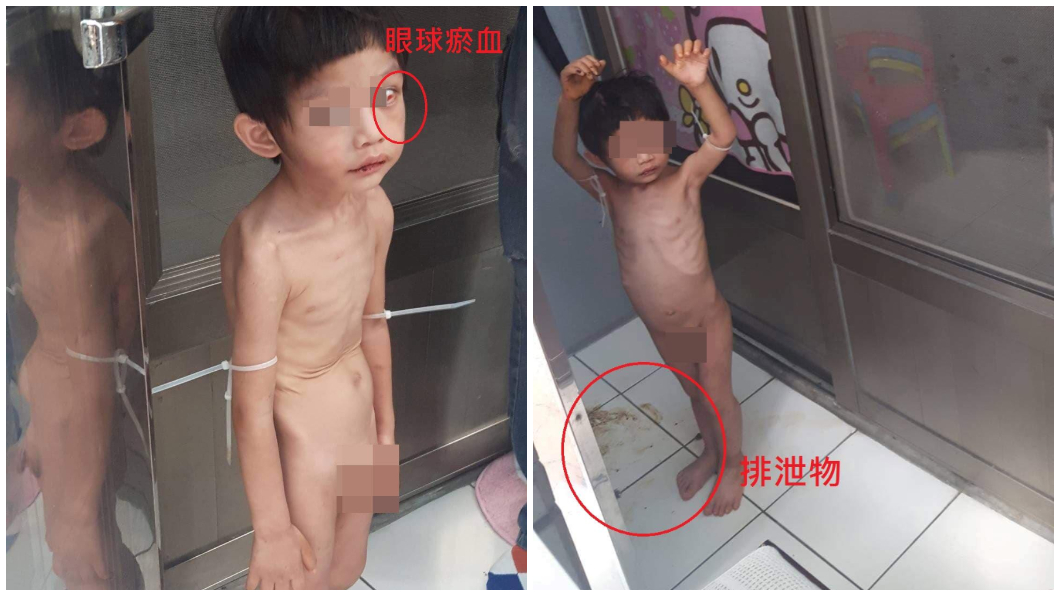 快訊/新竹男童疑遭虐! 治療後暫交由生母照顧