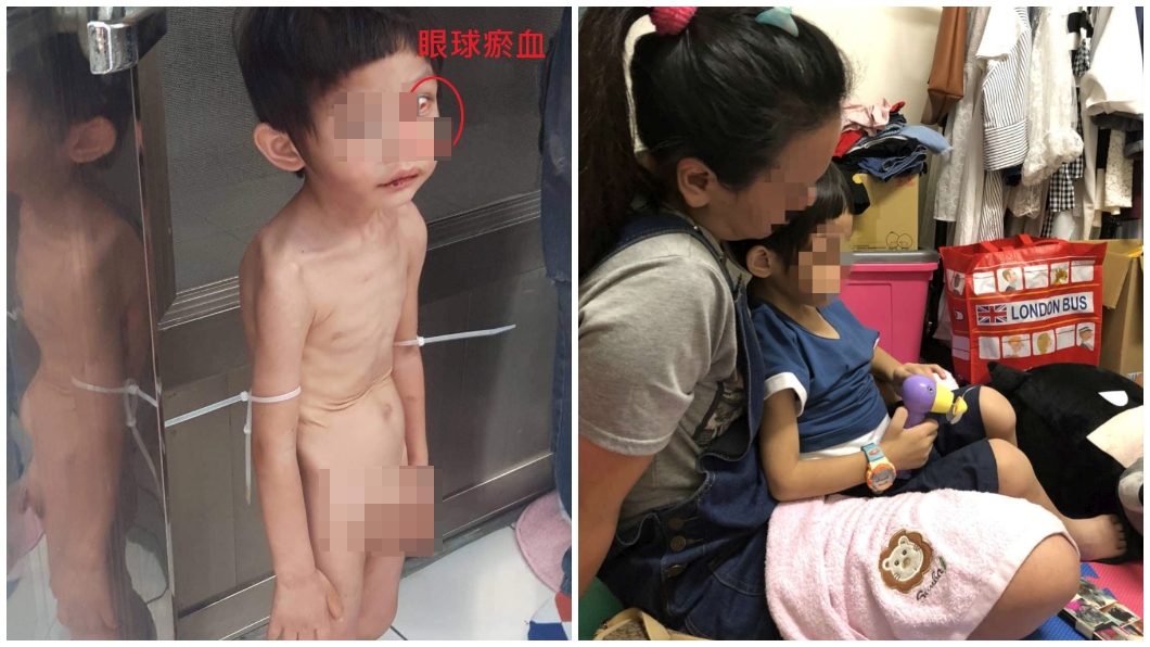受虐吃穢物3歲童已安置 生父:隨地大小便才綑束帶