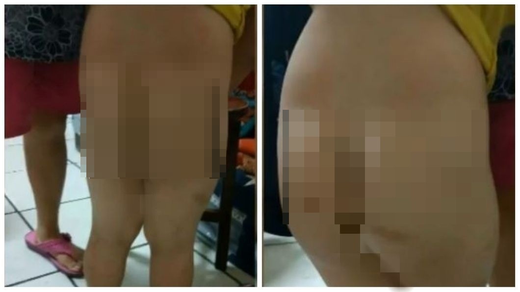 台中市一名父親日前從前妻家帶兒子回去過中秋節時,在幫他洗澡時發現身上有處傷痕。(圖/翻攝自黑色豪門企業臉書粉絲團)