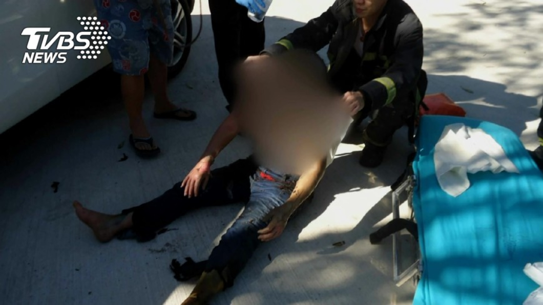 「沒耳朵、手指截肢」狠男被討錢!竟潑汽油燒女友害毀容