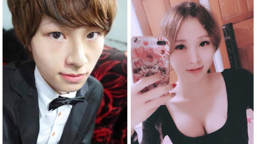 花美男「苦熬7手術」變正妹 萬人驚艷她笑:心臟要大顆