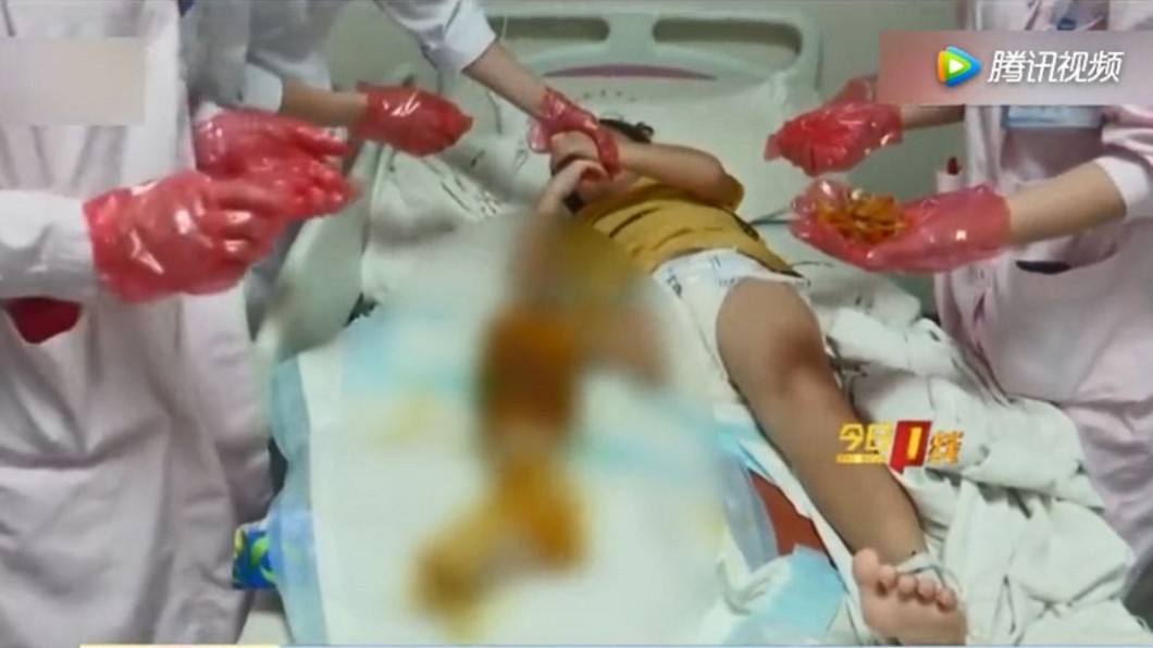 遭眼鏡蛇咬恐截肢!女童忍痛瞞病情 只想替爸省醫藥費