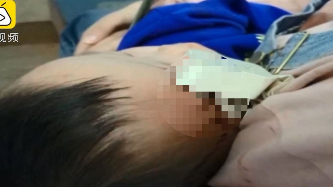 悚!2歲童睡覺滾下床 慘遭充電電源插額頭