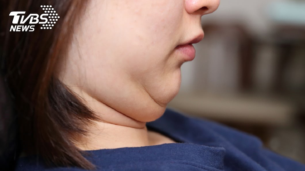 雙下巴是貴婦命!「幸福人妻」4種面相 肉肉女稱霸