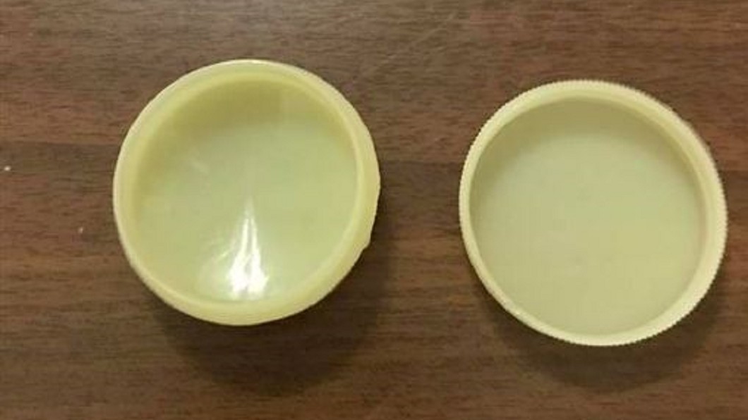 國王的藥膏?醫生叮嚀「很有效、按時擦」 打開後超傻眼
