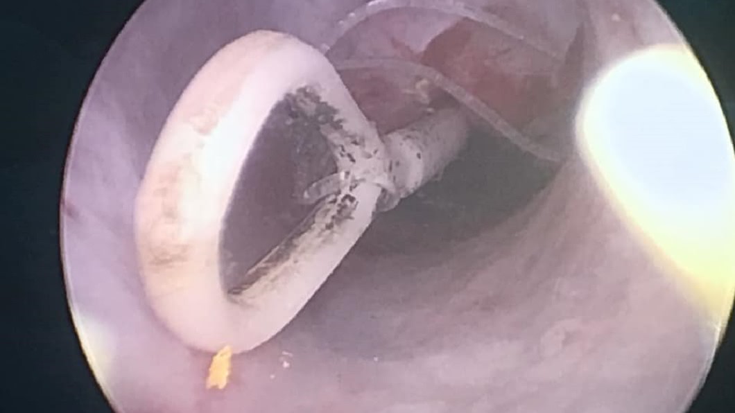 圖／翻攝自「鄭丞傑醫師健康教室」臉書