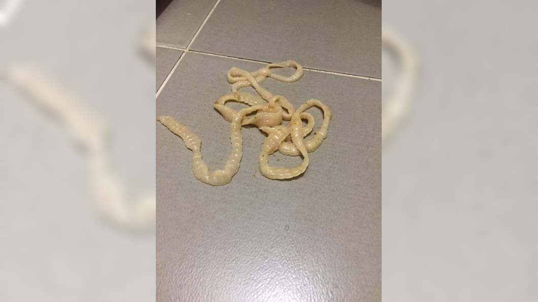 上廁所拉出2公尺白白的　他嚇傻：怎麼是腸子！