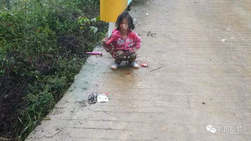 心碎!8歲女童上學途中 8條惡犬圍攻撕咬