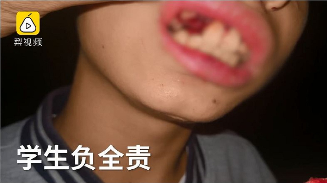 低頭騎車喝珍奶…少年撞停紅燈轎車 珍珠和4顆牙噴滿地