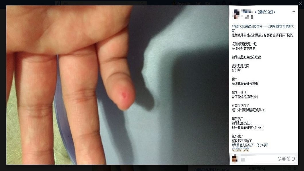 不少網友看到之後,也分享自己曾被蟑螂咬傷的經驗。(圖/翻攝自爆怨公社)