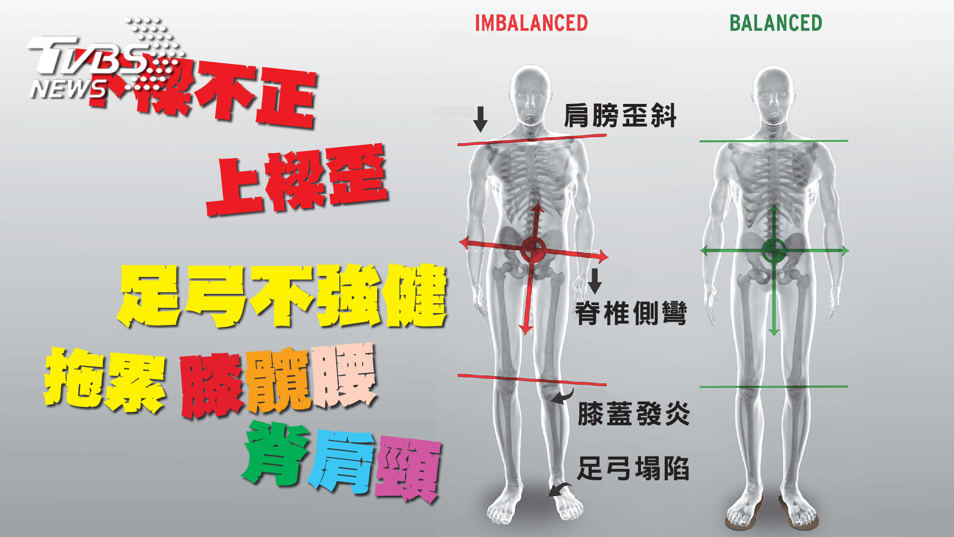腰痠背痛治不好 竟是足弓造成骨盆歪斜