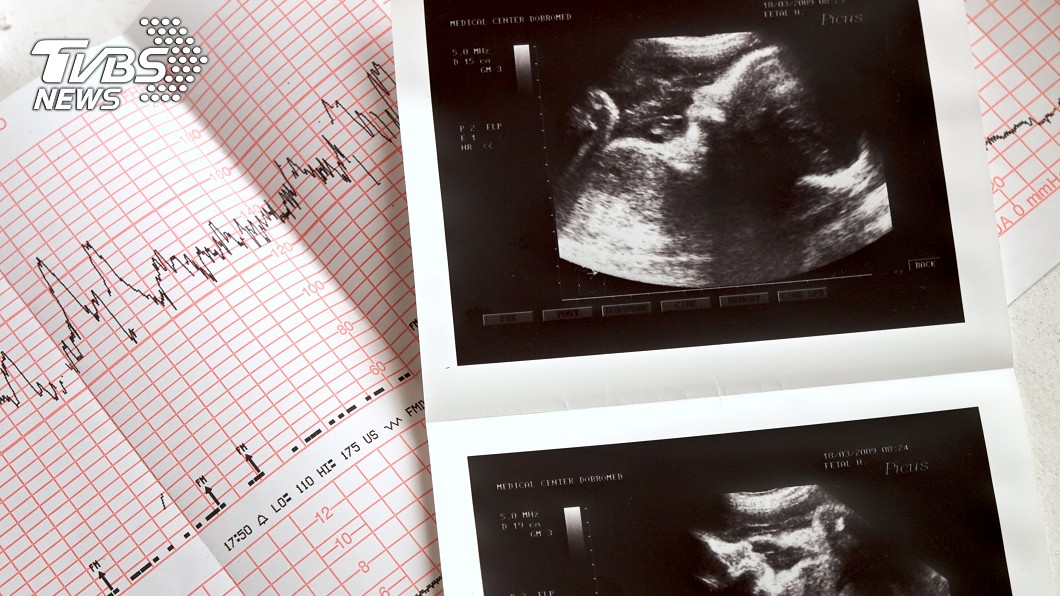 小媽媽冷回「想把孩子拿掉」 婦產醫手指心跳:他好好的
