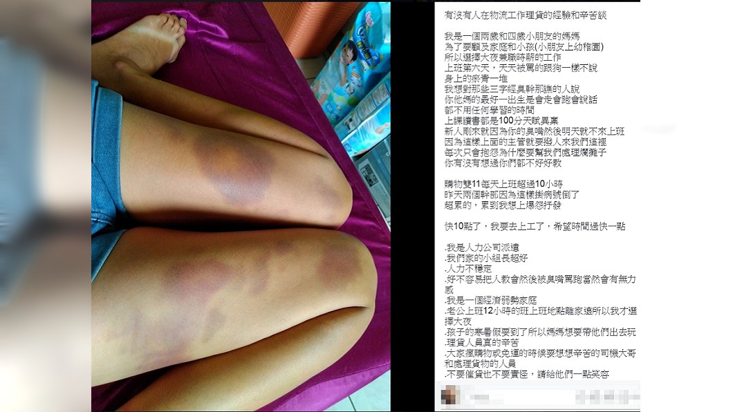 心疼！雙11消費者買翻　物流員理貨雙腿滿滿瘀青