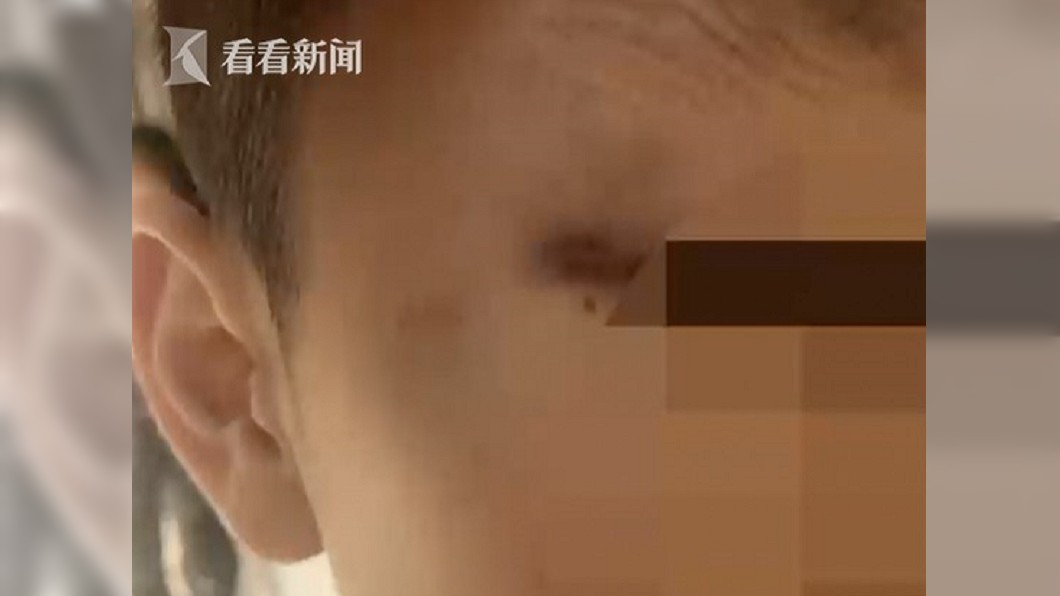 7歲男童只因想跟女老師玩 碰到胸部遭毒打一頓