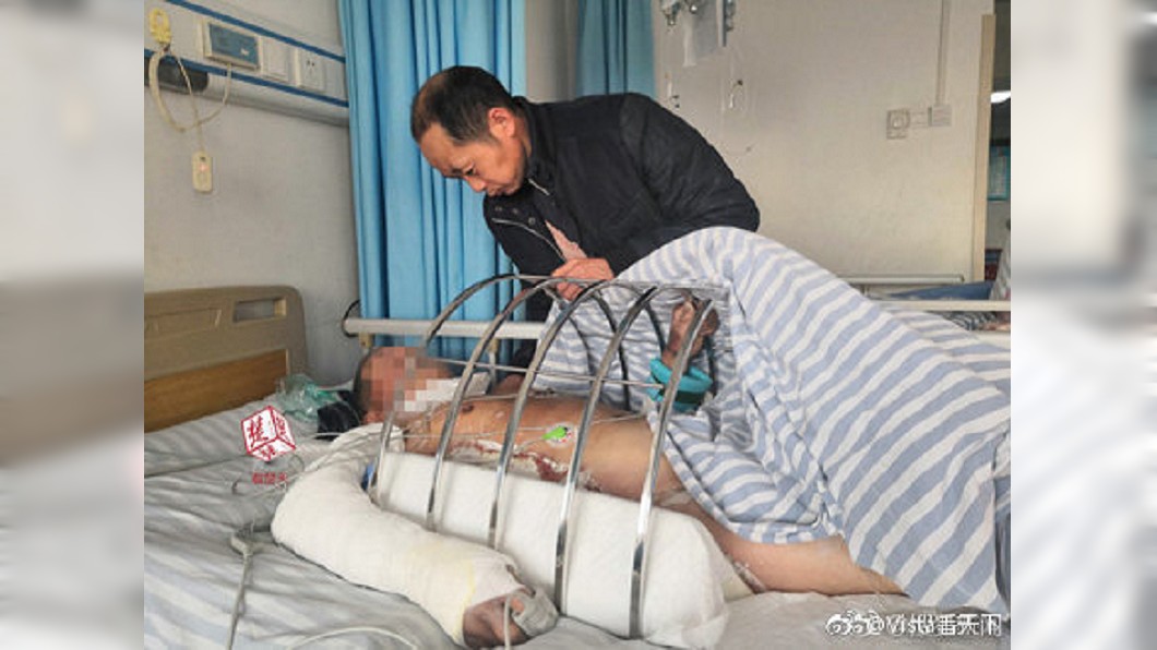 超狂逆襲！阿公殺豬慶生　被「垂死豬」踢進滾水灼傷