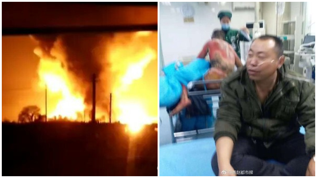 不如燒死!化工廠爆炸 傷患「全身焦黑」躺病床掙扎