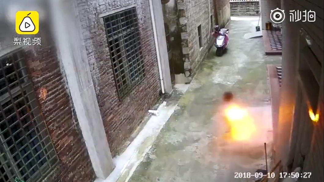 男童燒裙…3歲女變火球逃命 狂燒30分鐘「頭脖相黏」