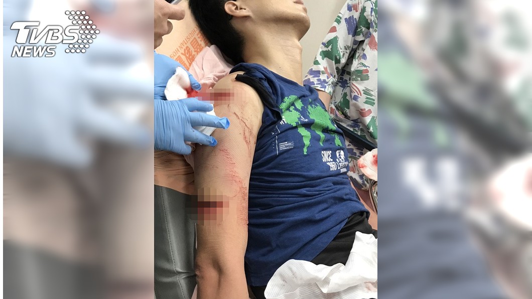 悚!婦鐮刀失控砍警 他2塊肉硬生生被削下