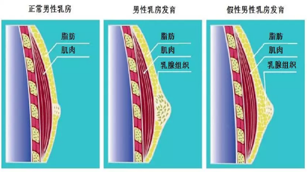 用了女友「這東西」半年 男大生胸部竟Up