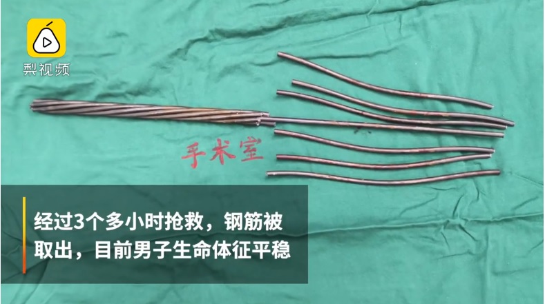 歷經3小時搶救,才終於將鋼筋取出。圖/截取自梨視頻