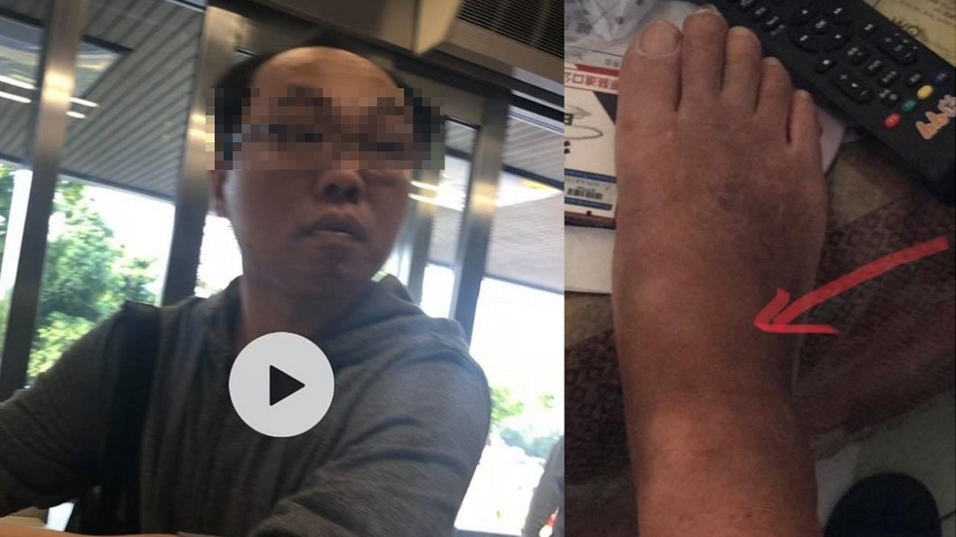強迫推銷愛心筆遭拒 男子怒踩老婦致右腳瘀青