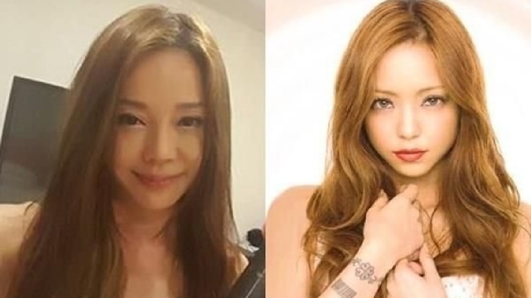 診所貼出狄鶯(圖左)和日本天后安室奈美惠的對比照。(圖／翻攝自醫美診所官網)