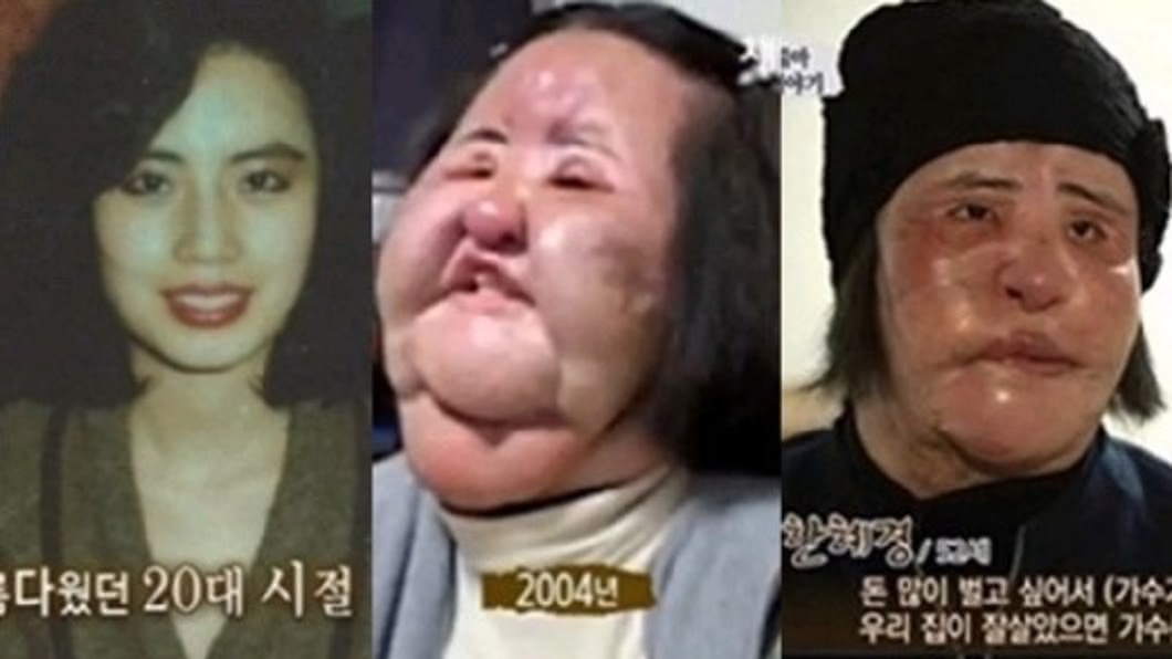 韓慧景在還沒接受非法整形前，其實也是個大美人。(圖／翻攝自韓網)