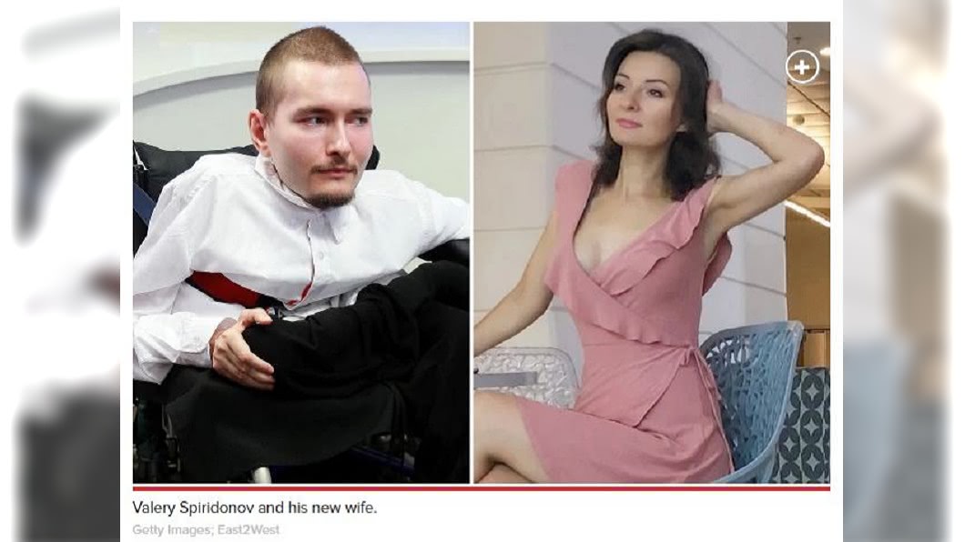 真愛!全身只剩頭手能動 男娶美艷辣妻還生子