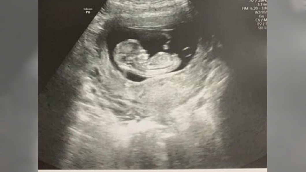 懷孕2個月被炒!孕婦家中還有1歲娃 無奈訴:怎麼生存