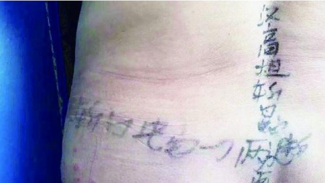 腰上寫咒！婦罹皮蛇痛到翻　竟請劉邦「出馬」保命