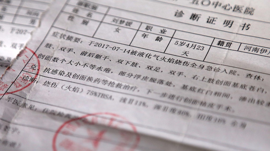 兄妹倆同時都遭灼傷,其中妹妹的傷勢比較嚴重。(圖/翻攝自陸網)