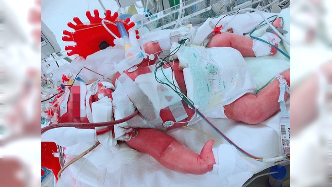 兒子「吐奶像噴泉」被說正常 出生15天…當小天使了