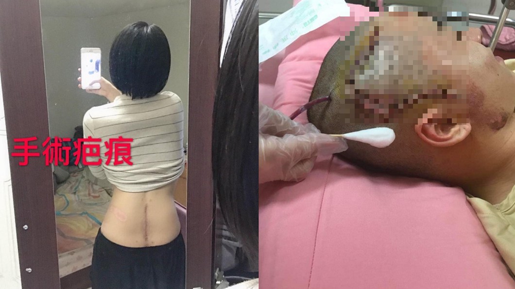 少女遭撞「大小便失禁」　肇事運將不道歉還反告