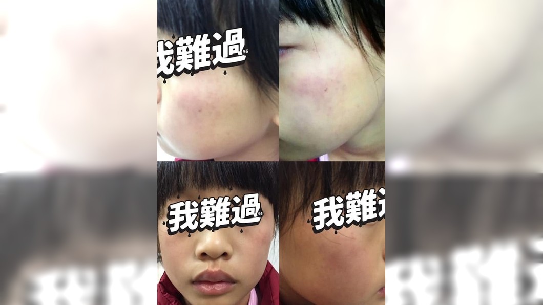 要女童自掌嘴200下 惡師遭懲4年不得受聘僱